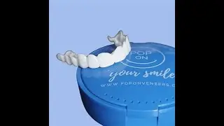 #PopOn Veneers review.