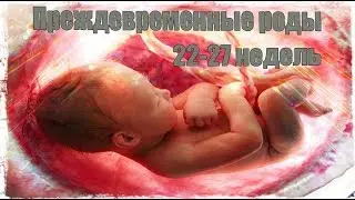 ПРЕЖДЕВРЕМЕННЫЕ РОДЫ 22 27 НЕДЕЛЬ