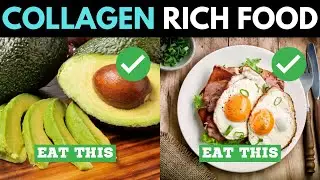 12 Best Collagen Rich Foods [For Amazing Skin & Hair]