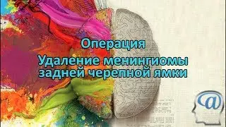 Операция. Удаление менингиомы задней черепной ямки. Нейрохирургия