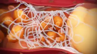 Metabolic-dysfunction Associated Steatohepatitis | MASH | liver disease animation
