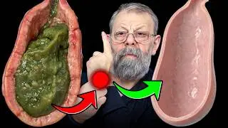 Ideal bile flow. Solution in 1 minute.