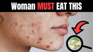 Balance Your Hormones Naturally: The Essential Guide for Women