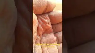nyamuk terkuat!!!!