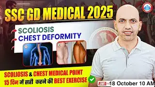 SSC GD Medical 2025 | 15 दिन में Scoliosis और Chest Deformity सही करने की Best Exercise