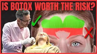 BOTOX RISK: How to Consult Patients on the Downsides Without Losing Them