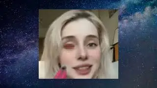 СВЕТА СОЛЛАР УДАЛИЛА ГЛАЗ !!!