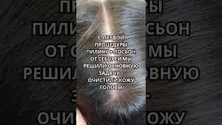 Жирная себорея. Пилинг кожи головы.  #уходзаволосами #волосы #hair #hairstyle