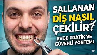 Sallanan Diş Nasıl Çekilir?
