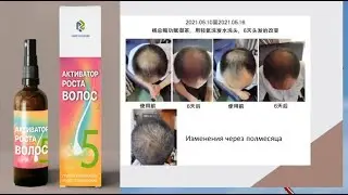 №5 Активатор роста волос