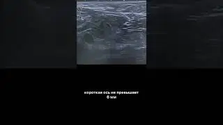 #узи #noderads #армдиассистент