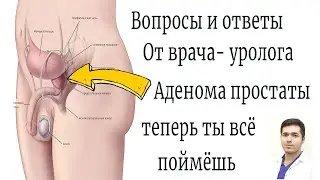 Доброкачественная гиперплазия предстательной железы вопросы и ответы от врача уролога