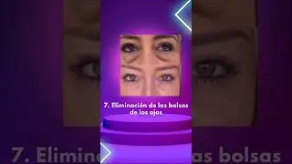 Fibroblast Curso Online de Rejuvenecimiento Facial con Plasmapen #fibroblast #plasmapen #cursoonline