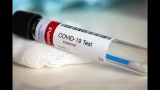 I Tested Positive For #COVID-19 | Ambitious