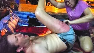 3AM SKIN SCRAPING STREET MASSAGE by Thai Lady with BUFFALO HORN 