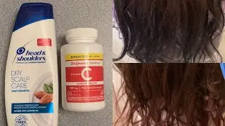 Como Quitar tinte del cabello || How to remove permanent box hair dye