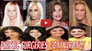 Plastic Surgeries Gone Wrong! 11 Actresses Who Look Horrible After Plastic Surgery| Worlds Top Rated