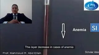 Significance of Hematocrit (Packed cell volume)