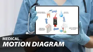 Motion Diagram for Medical Instructions | 2D Animation
