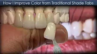 How I Improve Tooth Color from Traditional Shade Tabs | Dental Lab Education