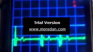 Single Lead postable ECG demo