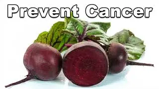9 Benefits of Beet Juice (And Why You Should Start ASAP)