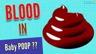 Blood in infant stool | Common cause of blood in an infant's stool !