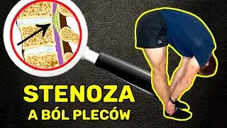 Stenoza odcinka lędźwiowego a przepuklina i kręgozmyk *ból pleców*