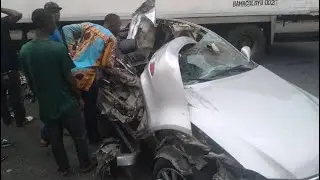 This Story Will Bring Tears To Your Eyes. |How I Lost My Leg In A Car Accident|