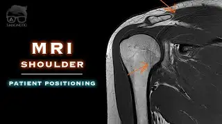 MRI – SHOULDER – PATIENT POSITIONING