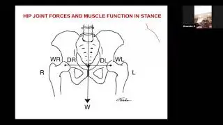 ABC of Joint Replacement : Session 5