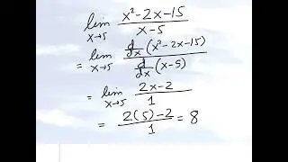 Calculus: Finding the limit of a rational function using L'Hopitals rule and by factoring