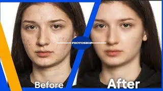 How to remove pimple like pro in photoshop?💥