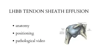 LONG HEAD BICEPS BRACHII TENDON SHEAT EFFUSION - musculoskeletal ultrasound examination