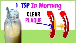 Only 3 Ingredients to clear Clogged Arteries and Reduce Cholesterol Naturally