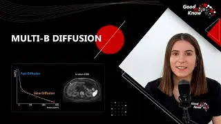 Good to Know - Multi-b Diffusion