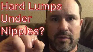 Hard lumps under nipples - adolescent males 😨