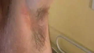 Fungal infection