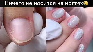 Не носится ничего на ногтях, плак😢 укрепление ногтей акригелем #укреплениеакригелем #комбиманикюр