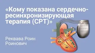 Нерегулярный сердечный ритм. Кому показана терапия