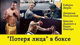 «Потеря лица» в боксе: Роберто Дюран, Джеральд Макклелан, Максим Дадашев и Бадди Макгирт