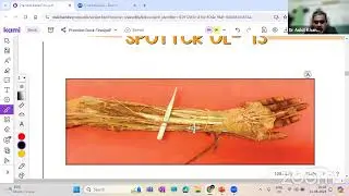 45 Days To MBBS Finals Intensive Revision Series Live Class Anatomy about Upper limb by Dr. Ankit