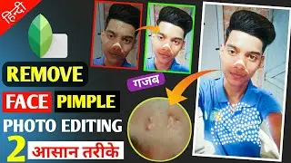 🔥How to Clean Face +Remove pimples +Clear Face bay edit  snapeed photo editing snapseed Face editing