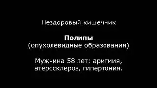 Чистый организм = Высокие вибрации. И наоборот.