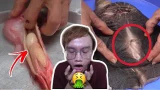 DON'T WATCH THIS WHILE EATING! IT'S A BIG PAIN...