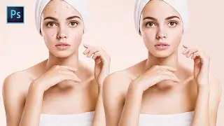 How to Remove Acne in Photoshop | Remove pimples (fast and easy)