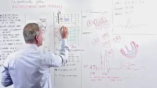 EKG Made Easy
