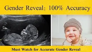 Can You Really Predict Baby’s Gender with 100% Accuracy?