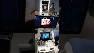El training en el HS40v1.04