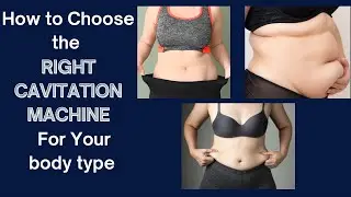 Cavitation for Home Use | How to pick the BEST CAVITATION MACHINE for your body type